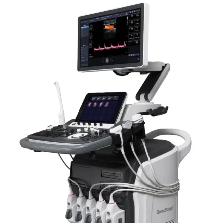 УЗИ аппарат SonoScape S40