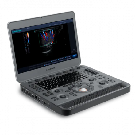 УЗИ сканер Sonoscape S2N